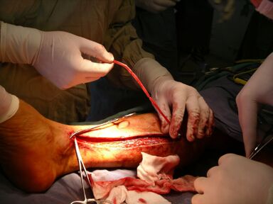 Operacion